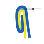 Seam Gap